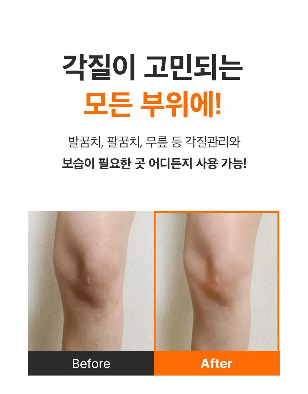 [데일리풋케어/맨들맨들아기발] 성분에디터 시어버터 베이비 풋 스틱 20g 2종 택 1 상세페이지 63
